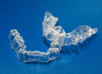 Clear Aligner Braces