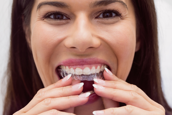 woman wearking clear aligners 