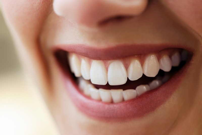 A women smiling after visiting a dental hygienist Glasgow