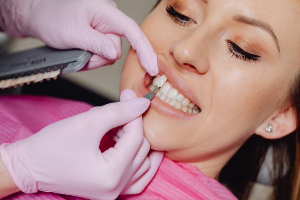 porcelain veneers being fitted 